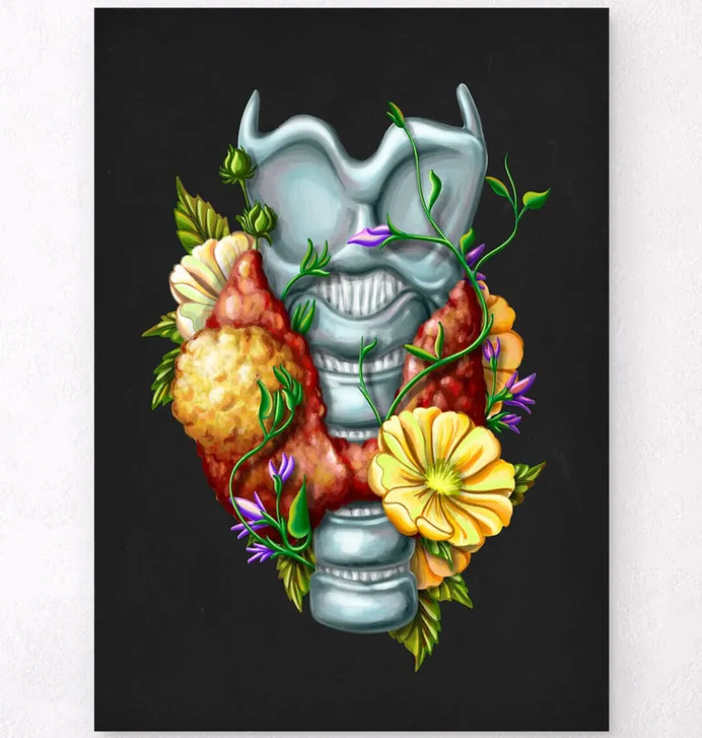 Adénome thyroïdien - Floral - Noir