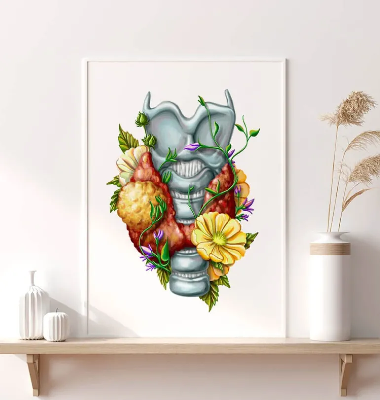 Adénome thyroïdien - Floral - Blanc