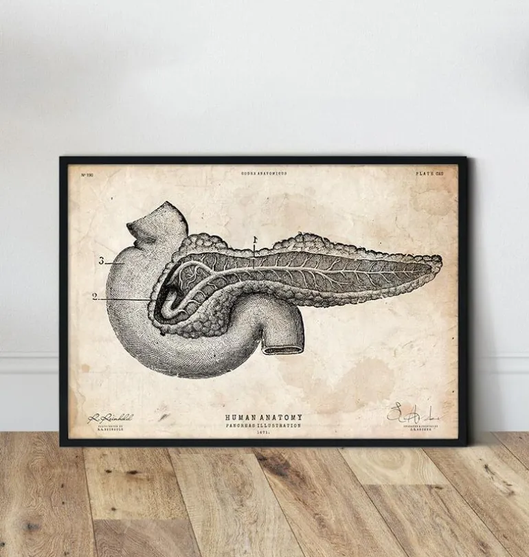 Affiche d'anatomie du pancréas