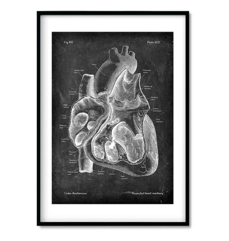 Anatomie cardiaque - Chalkboard - Lot de 3