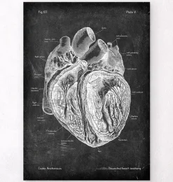 Anatomie cardiaque disséquée - Chalkboard