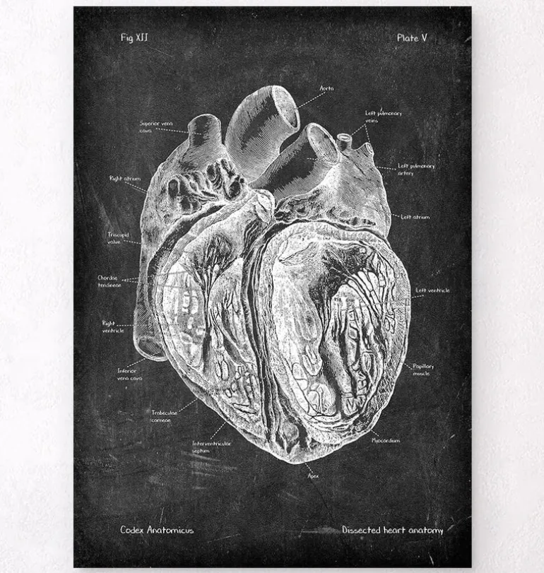 Anatomie cardiaque disséquée - Chalkboard