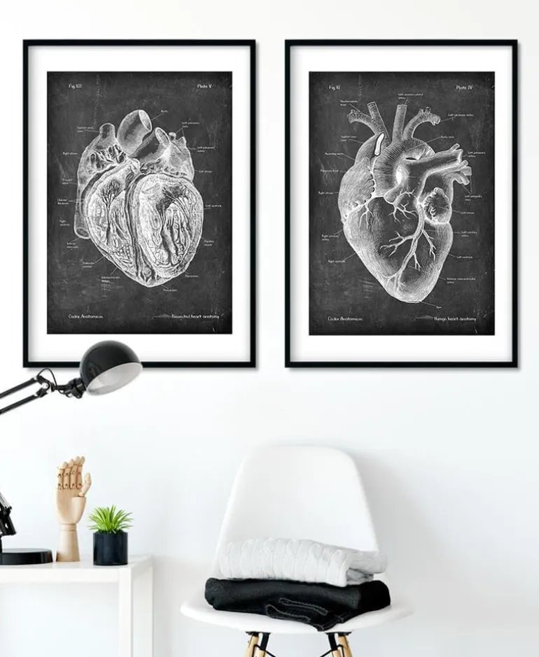 Anatomie cardiaque disséquée - Chalkboard