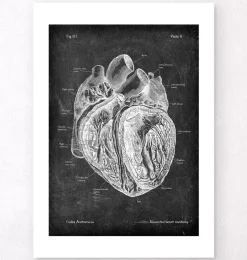 Anatomie cardiaque disséquée - Chalkboard
