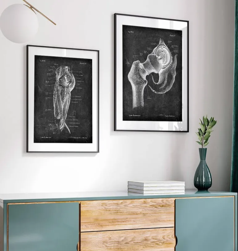 Anatomie de la hanche - Chalkboard