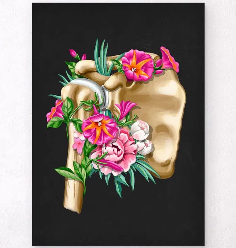 Anatomie de l'épaule - Floral - Noir