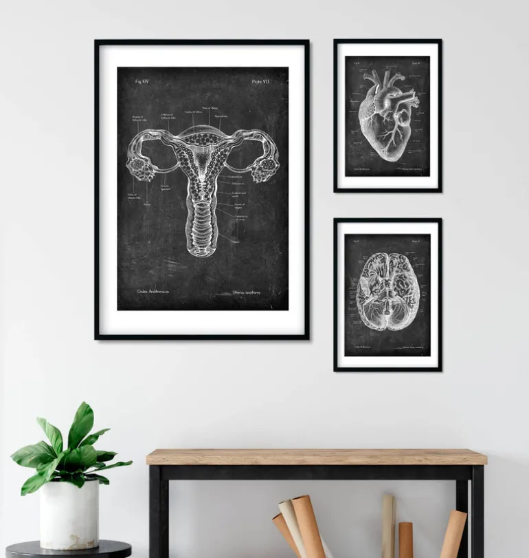Anatomie de l'utérus - Chalkboard