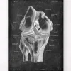 Anatomie du genou - Chalkboard