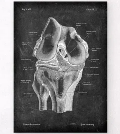 Anatomie du genou - Chalkboard