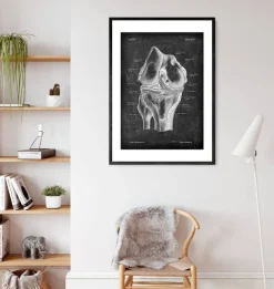 Anatomie du genou - Chalkboard
