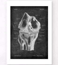 Anatomie du genou - Chalkboard