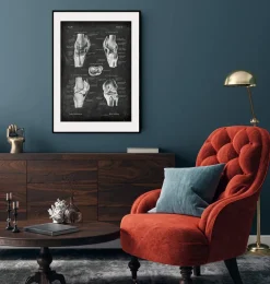 Anatomie du genou II - Chalkboard