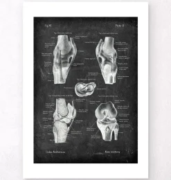 Anatomie du genou II - Chalkboard