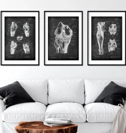 Articulation du genou et muscles des jambes - Chalkboard