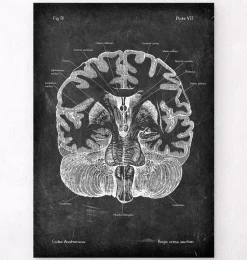Cerveau disséqué - Chalkboard