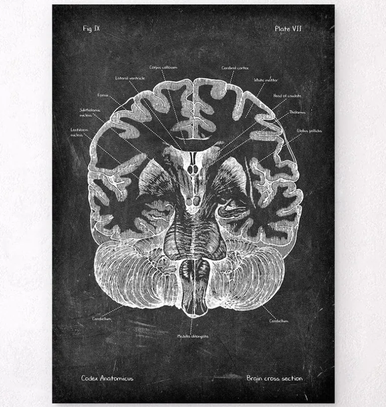 Cerveau disséqué - Chalkboard