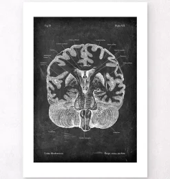 Cerveau disséqué - Chalkboard