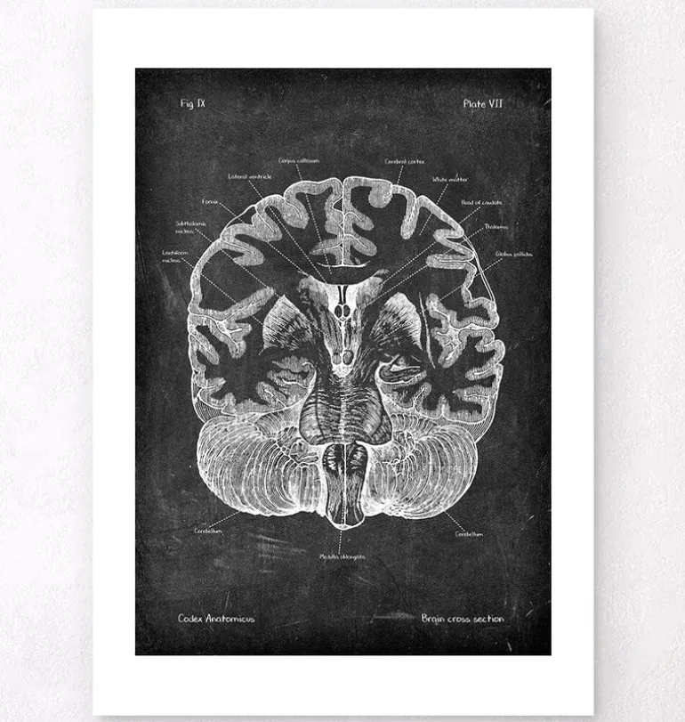 Cerveau disséqué - Chalkboard