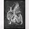 Dissected heart anatomy II - Chalkboard