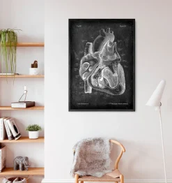 Dissected heart anatomy II - Chalkboard