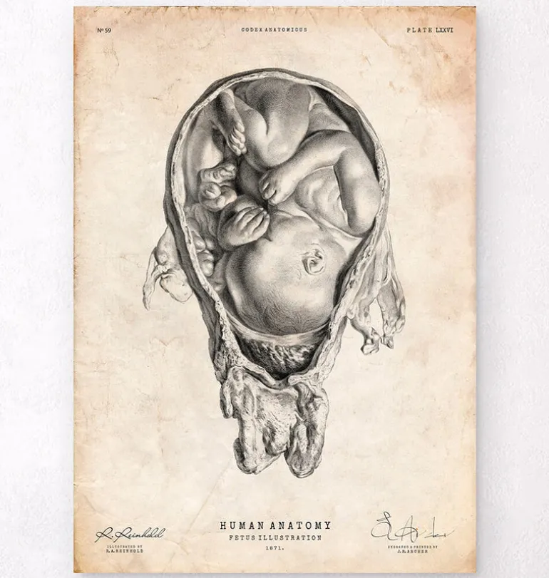 Foetus dans un utérus