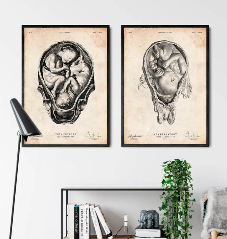 Foetus dans un utérus