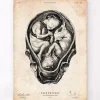 Foetus II