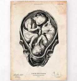 Foetus II