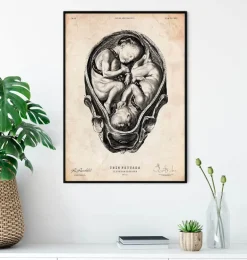 Foetus II