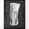 Fosse poplitée - Chalkboard