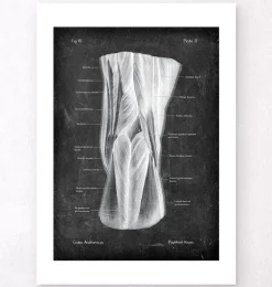 Fosse poplitée - Chalkboard