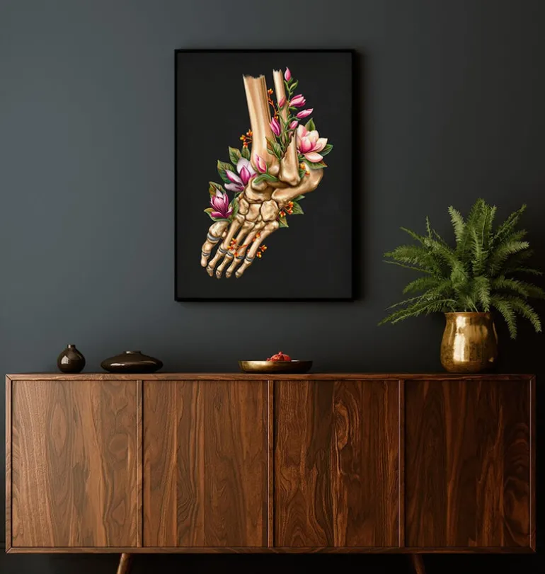 Fracture de la cheville - Floral - Noir