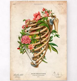 Fracture des côtes - Floral - Vintage