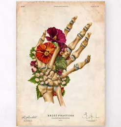 Fracture du poignet - Floral - Vintage