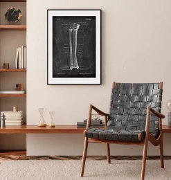 Tibia et fibula - Chalkboard