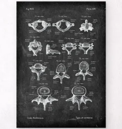 Types de vertèbres - Chalkboard