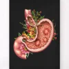 Ulcère gastrique - Floral - Noir