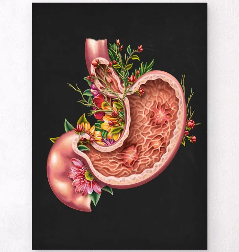 Ulcère gastrique - Floral - Noir