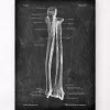 Ulna et radius - Chalkboard