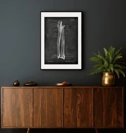 Ulna et radius - Chalkboard