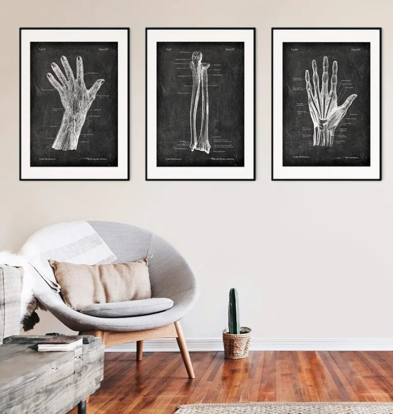 Ulna et radius - Chalkboard