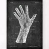 Vaisseaux sanguins de la main - Chalkboard