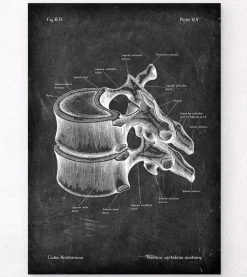 Vertèbre thoracique - Chalkboard